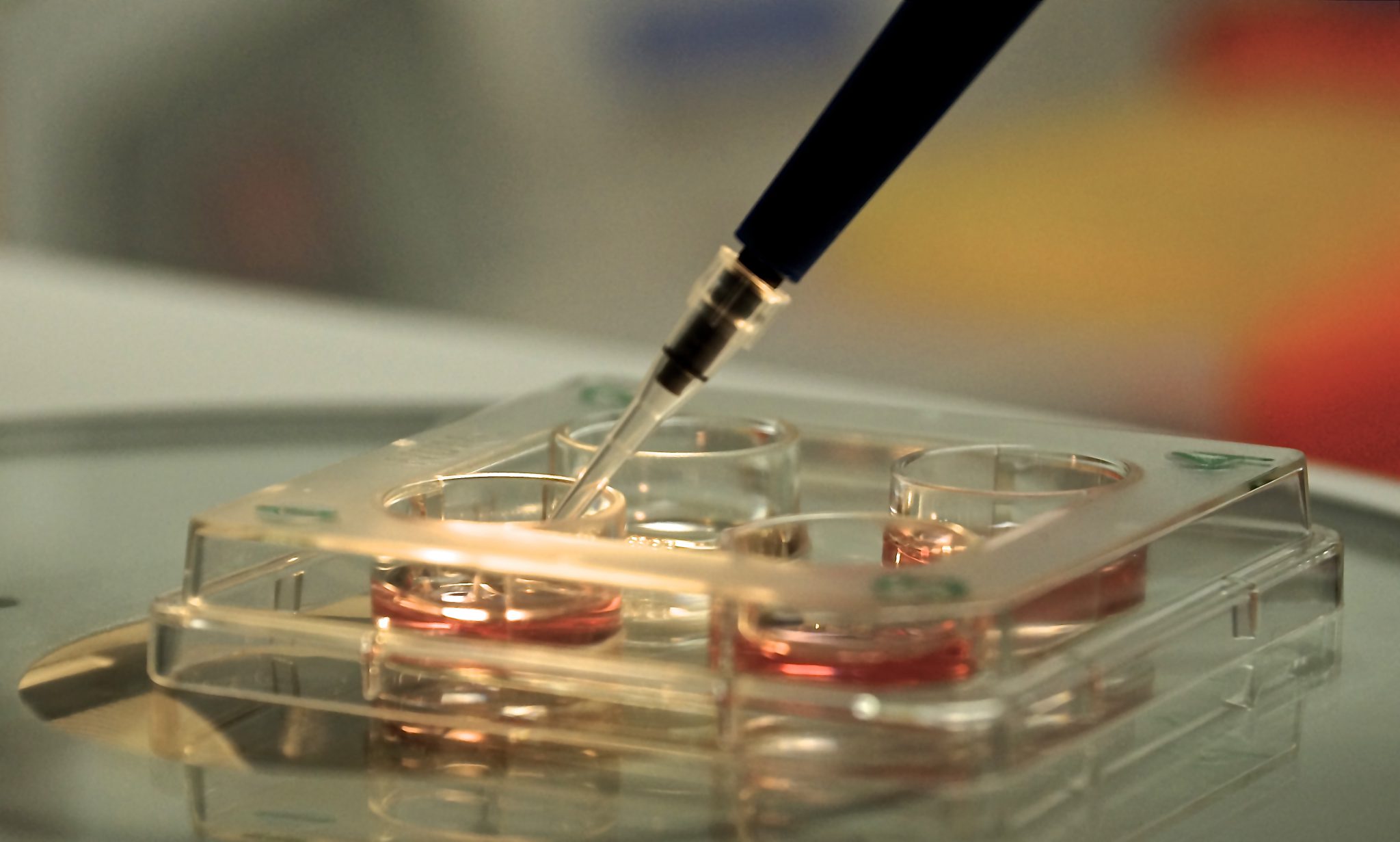 ¿Por qué In vitro? – In vitro Colombia
